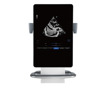 Mindray - Diagnostic Ultrasound System TE9
