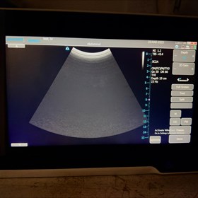 u3200T Ultrasound