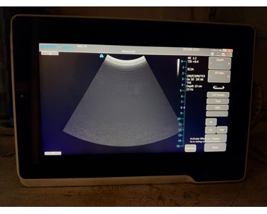 Terason - u3200T Ultrasound