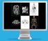 GE Healthcare - 3D Imaging System | Volume Viewer