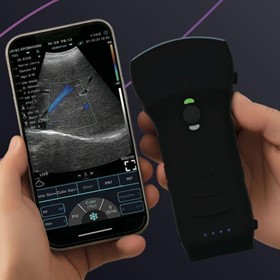 C10TX-PRO Dual Head Convex & Linear Hand-Held Ultrasound