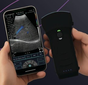 C10TX-PRO Dual Head Convex & Linear Hand-Held Ultrasound