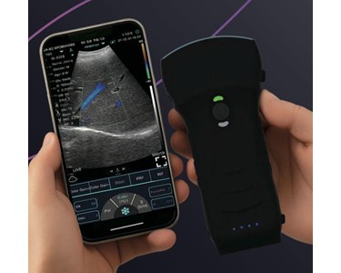 C10TX-PRO Dual Head Convex & Linear Hand-Held Ultrasound