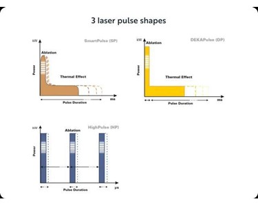 Deka - CO2 Fractional Laser PSD Technology | Tetra PRO
