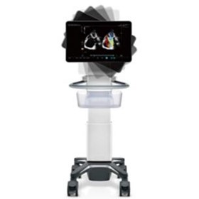 Point of Care Ultrasound System - TEX20 Elite Edition