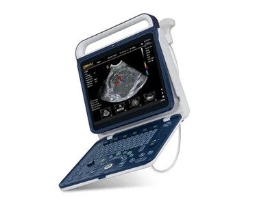 BMV BPU60 OPU OVUM PICK-UP Portable Vet Colour Doppler Ultrasound