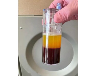 High Platelet and Purity PRP | EmCyte PureTWO