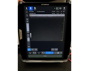 GE - Venue 50 Ultrasound EX-LHC204