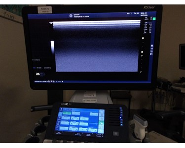 GE - Logiq S8 with XD Clear | Ultrasound Machine | EX3576