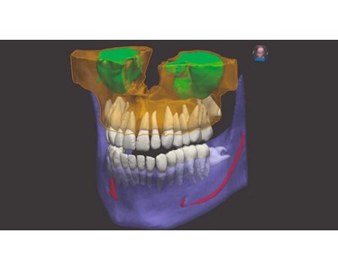 NeoWise Software - Dental Imaging Software – NeoWise
