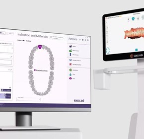 Dental Imaging Software | IOS for labs