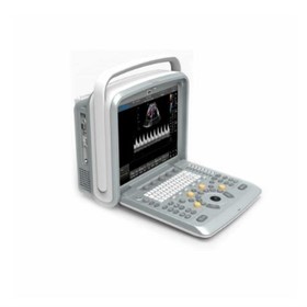 Portable Ultrasound Machine | Q9