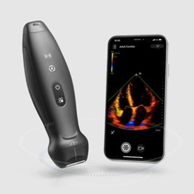 Wireless Handheld Ultrasound System | TE Air 