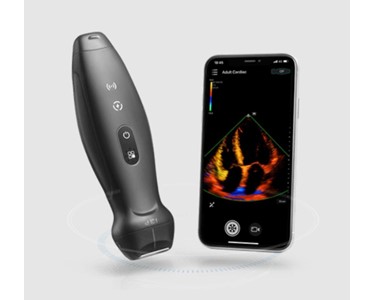 Mindray - Wireless Handheld Ultrasound System | TE Air 