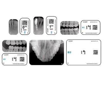 Dental Xray Scanner | ScanX Duo Touch