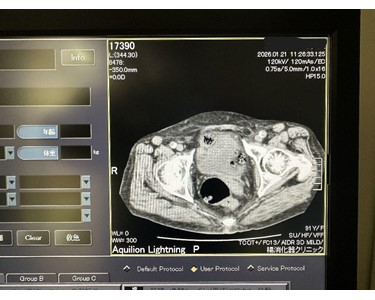 Canon - Aquilion Lightning 32 Slice