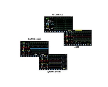 Northern Meditec - Patient Monitor | Anaesthesia (Gemini)