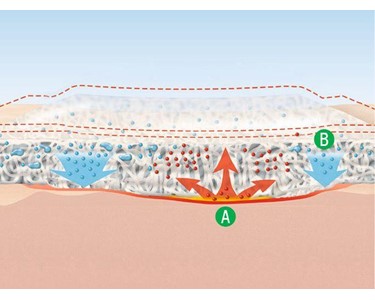 Lohmann & Rauscher - Wound Dressing | Suprasorb X