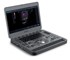 SonoScape - X5 real-time portable Colour Doppler Laptop Ultrasound Machine