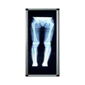 X-Ray Viewer | Full Spine LED Viewing Box