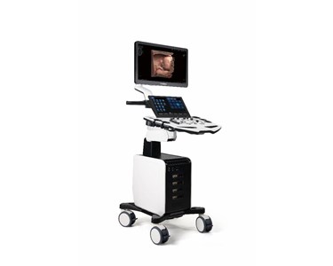 Vinno - Cart-Based Ultrasound | VINNO S300 
