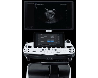 Crystal-Clear Image Samsung V8 Ultrasound