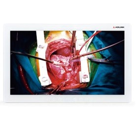 Medical Monitor ASM24FHB