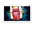 Medical Monitor ASM24FHB