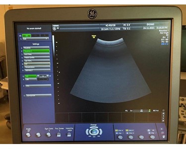 GE -  Voluson S6 -3D/4D ultrasound machine - (EX2660)