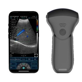 Convex Ultrasound Probes B&W + Colour Dopplers with PW