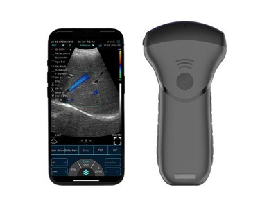 Convex Ultrasound Probes B&W + Colour Dopplers with PW