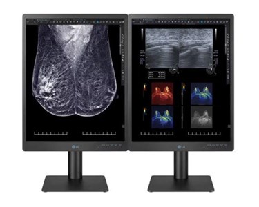 LG - 5MP 21″ Color Mammography 3D-Tomosynthesis Two-Monitor Display Setup