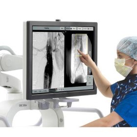 Medical Imaging Viewer | OEC Elite CFD