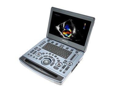 Mindray - Premium Diagnostic Portable Ultrasound System | M8