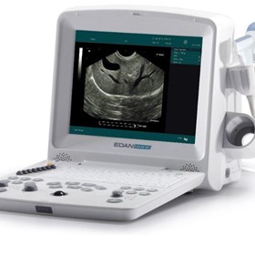 Vet Ultrasound System | DUS60 