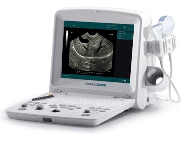 Edan - Vet Ultrasound System | DUS60 