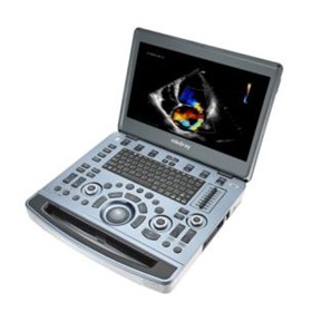 Premium Diagnostic Portable Ultrasound System | M8