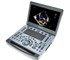 Mindray - Premium Diagnostic Portable Ultrasound System | M8