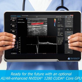 uSmart 3200T Plus Colour Doppler Ultrasound Machine