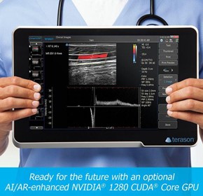 uSmart 3200T Plus Colour Doppler Ultrasound Machine