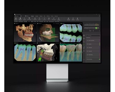 Dexis - Imaging Software | Studio Clinic Imaging Software