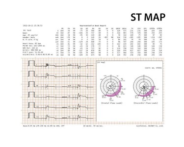 Bionet - Cardio P1 PC-Based ECG with Interpretation