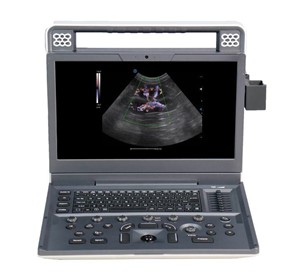 V9 Lite Digital Color Doppler Veterinary Ultrasound Imaging System 