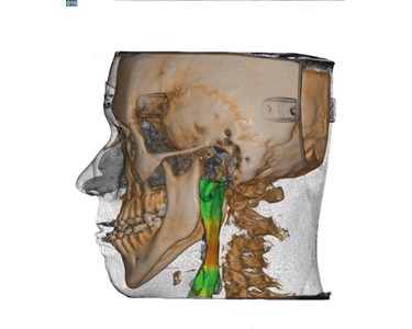 NewTom - VGi EVO 2D/3D CBCT X-ray 