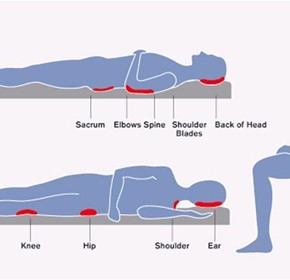 What is the term for ulcers & sores caused by pressure & shear forces?