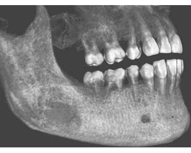 CBCT System | ProVecta 3D Prime