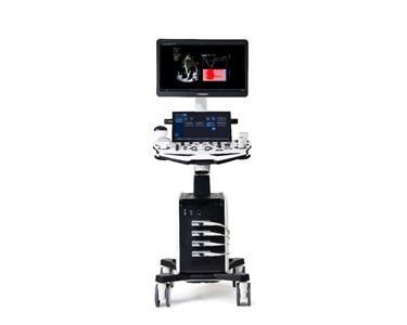 Vinno - Cart-Based Ultrasound | VINNO S300 