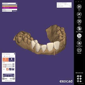 Dental Imaging Software | DentalCAD