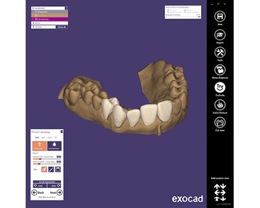 ExoCad - Dental Imaging Software | DentalCAD