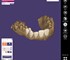 ExoCad - Dental Imaging Software | DentalCAD